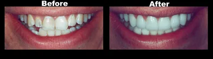 Case_1